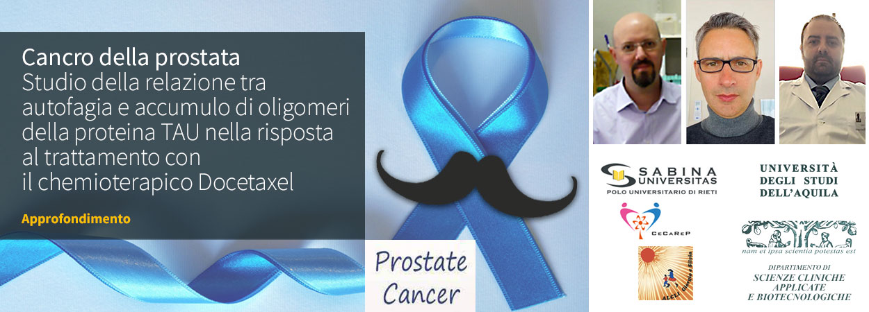 Cancro della prostata | Studio della relazione tra autofagia e accumulo di oligomeri della proteina TAU nella risposta al trattamento con il chemioterapico Docetaxel